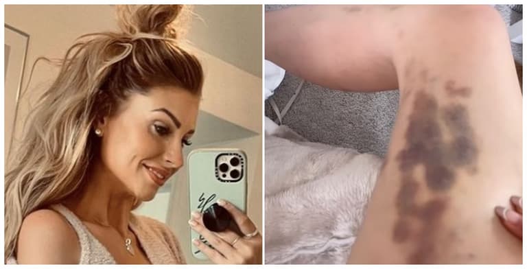 Mrs Hinch reveals why she always covers up – even in summer Mrs Hinch reveals why she always covers up – even in summer