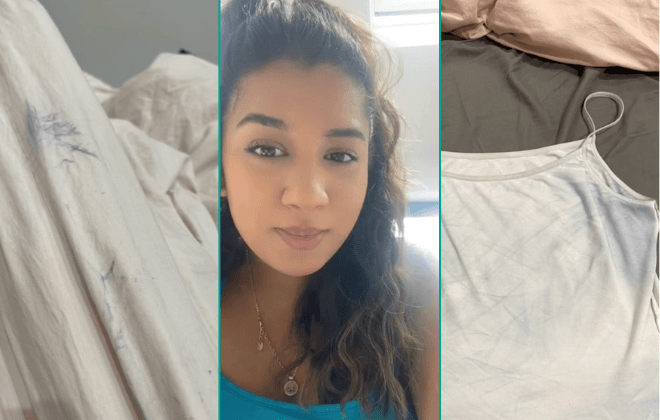 Chromhidrosis and pregnancy: The rare condition explained Chromhidrosis and pregnancy: The rare condition explained