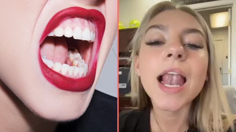 ‘Gleeking’ is the ‘disgusting’ bodily function that most people don’t know they can do ‘Gleeking’ is the ‘disgusting’ bodily function that most people don’t know they can do