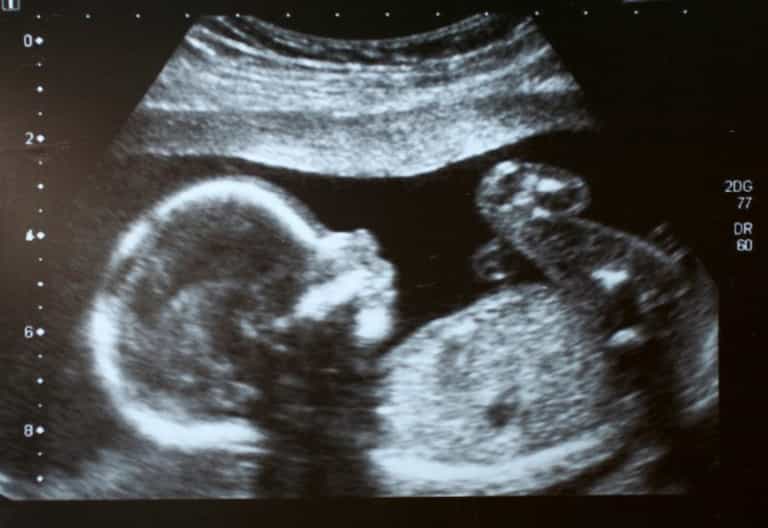 Pregnancy myths: Half of the couples do not know the best ways to conceive Pregnancy myths: Half of the couples do not know the best ways to conceive