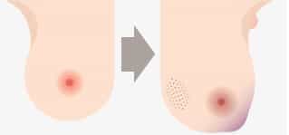 Cancer: These Early Warning Signs Could Save Your Life Cancer: These Early Warning Signs Could Save Your Life