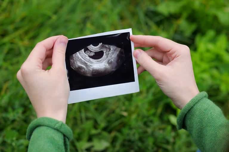 This woman didn’t know she was going to be a mum until she was 8 months pregnant This woman didn’t know she was going to be a mum until she was 8 months pregnant