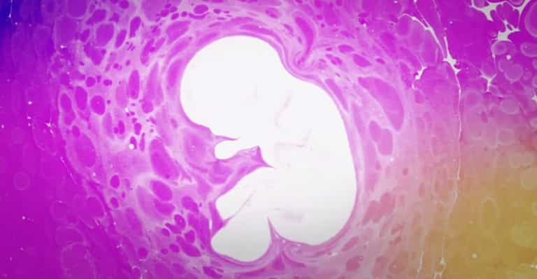 WATCH: This amazing video shows what REALLY happens during IVF WATCH: This amazing video shows what REALLY happens during IVF