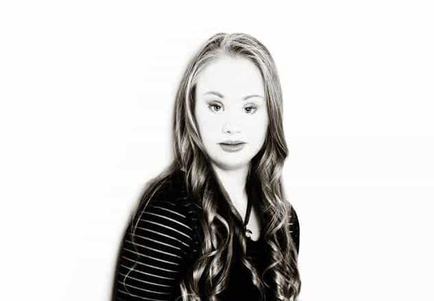 This Aussie teen is challenging our perceptions of beauty and disabilities This Aussie teen is challenging our perceptions of beauty and disabilities
