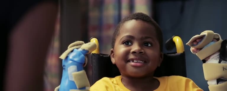 This little boy is the youngest patient to receive a double hand transplant This little boy is the youngest patient to receive a double hand transplant