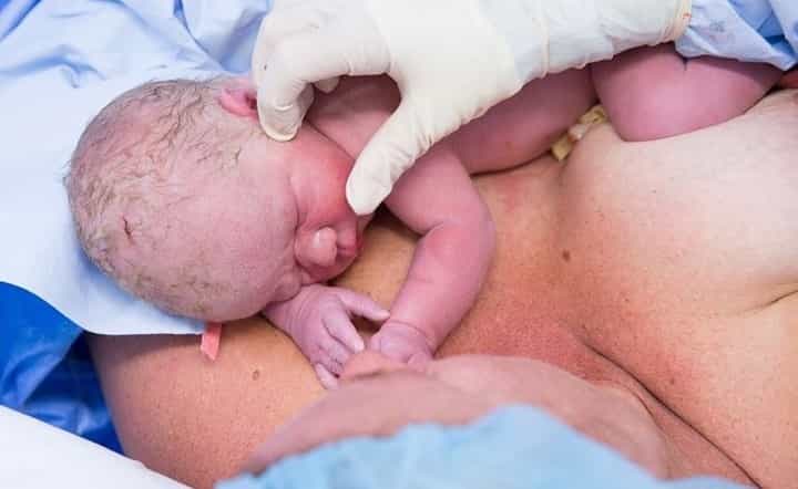This mum just delivered her own baby. By C-section This mum just delivered her own baby. By C-section