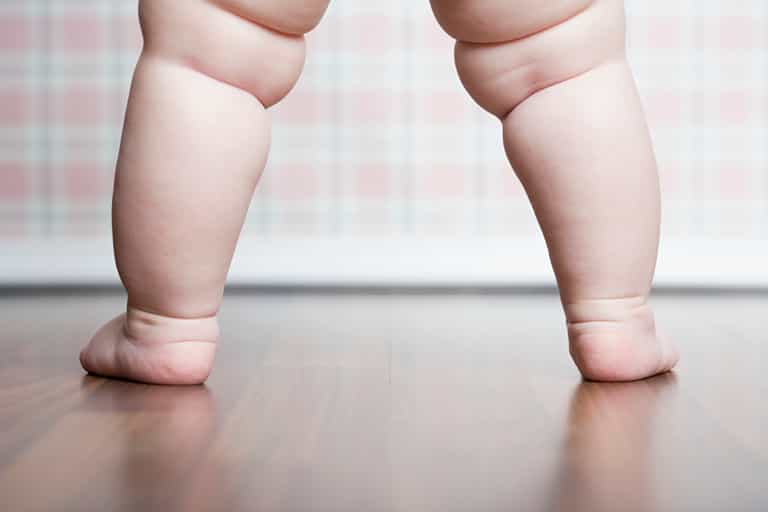 3-year-old girl diagnosed with type-2 diabetes 3-year-old girl diagnosed with type-2 diabetes
