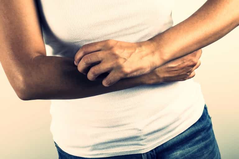 Psoriasis – Is diet part of the problem? Psoriasis – Is diet part of the problem?