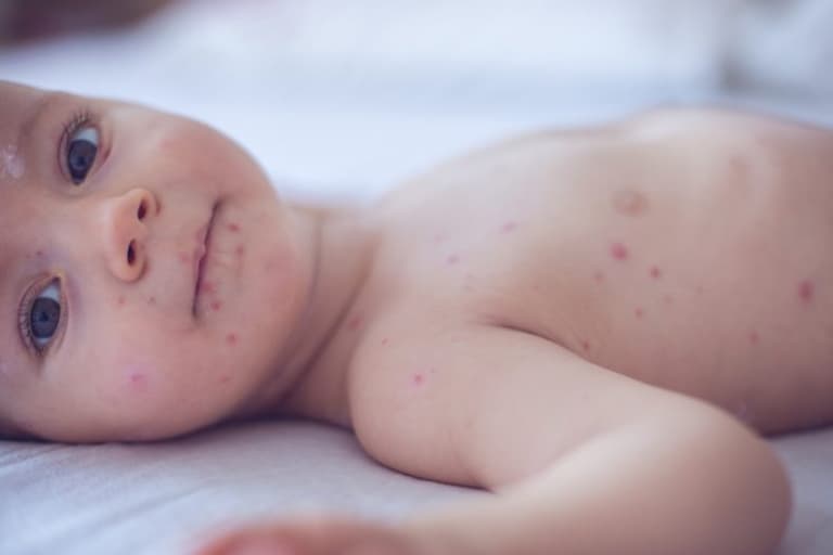 Researchers examine why ‘anti-vaxxers’ decide against immunising Researchers examine why ‘anti-vaxxers’ decide against immunising