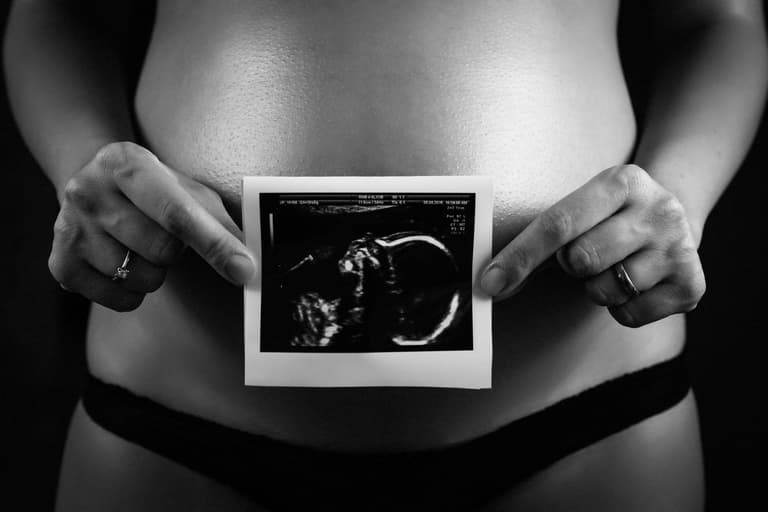 Ever heard of the ‘nub theory’? It claims to reveal your baby’s sex at 12 weeks Ever heard of the ‘nub theory’? It claims to reveal your baby’s sex at 12 weeks