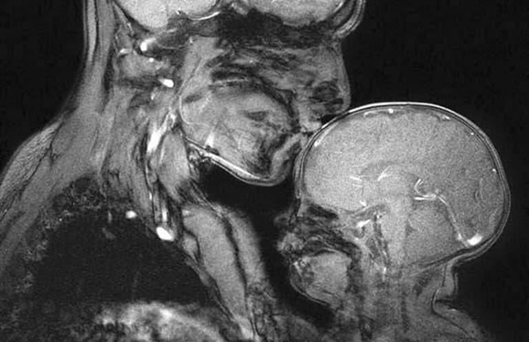 This Mama /Baby MRI Scan Shows The Fragility Of Human Life This Mama /Baby MRI Scan Shows The Fragility Of Human Life