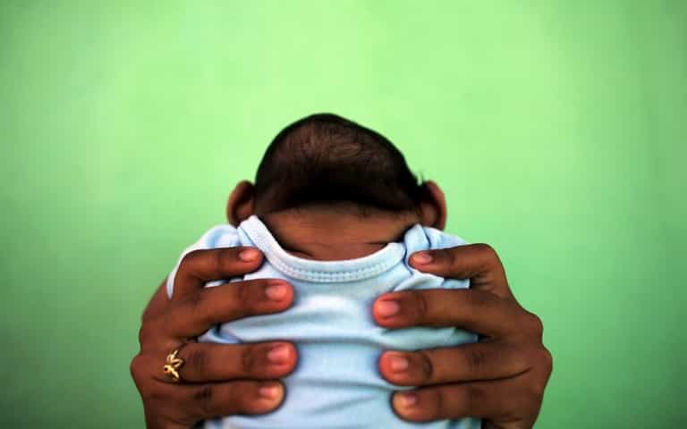 Zika Brain Damage ‘Worse Than Reported’, Says Neurologist Zika Brain Damage ‘Worse Than Reported’, Says Neurologist