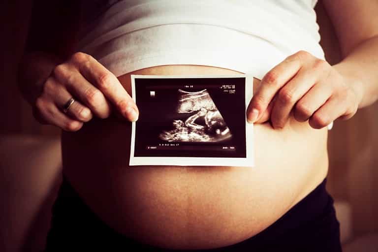 Heartbreaking Ultrasound Shows Dying Baby Holding Twin Sister’s Hand Heartbreaking Ultrasound Shows Dying Baby Holding Twin Sister’s Hand