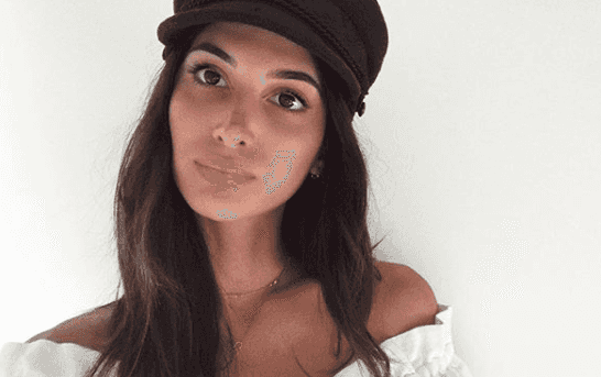 Fashion designer explains her ‘tiny baby bump’ is due to endometriosis Fashion designer explains her ‘tiny baby bump’ is due to endometriosis