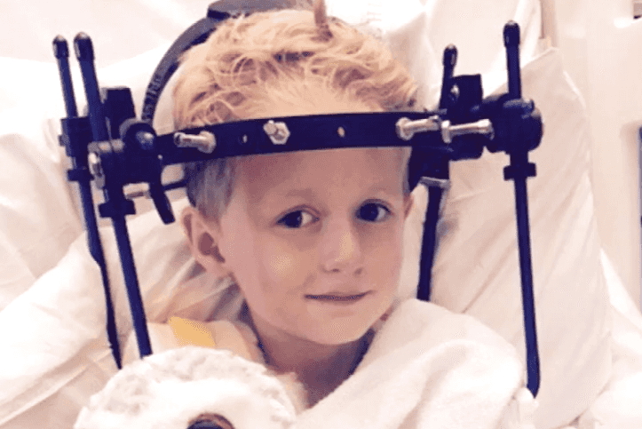 A little boy broke his neck but doctors missed it for 5 weeks A little boy broke his neck but doctors missed it for 5 weeks