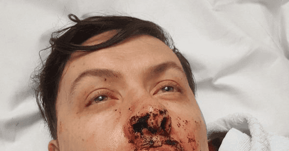 Couple left severely injured after suspected homophobic attack Couple left severely injured after suspected homophobic attack