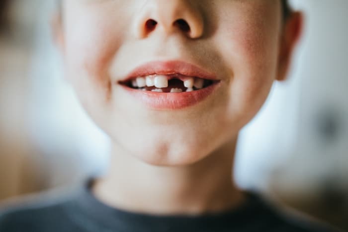 Mum shares photos after toddler accidentally pulls tooth out with tape Mum shares photos after toddler accidentally pulls tooth out with tape