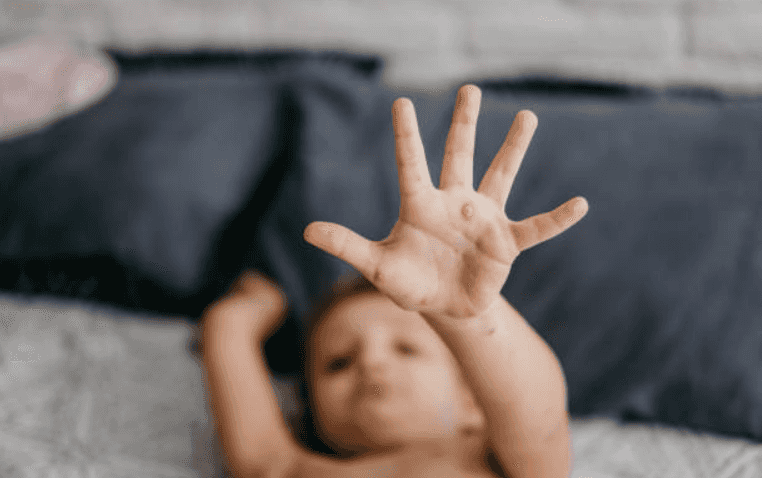 Parents in New York are holding ‘measles parties’ to expose unvaccinated kids Parents in New York are holding ‘measles parties’ to expose unvaccinated kids
