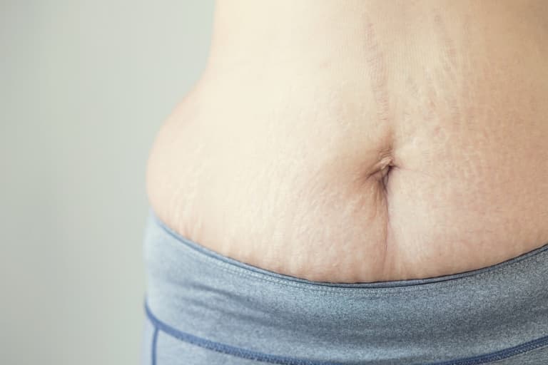 In a world of perfection here’s to the mums with stretch marks and mum tums In a world of perfection here’s to the mums with stretch marks and mum tums