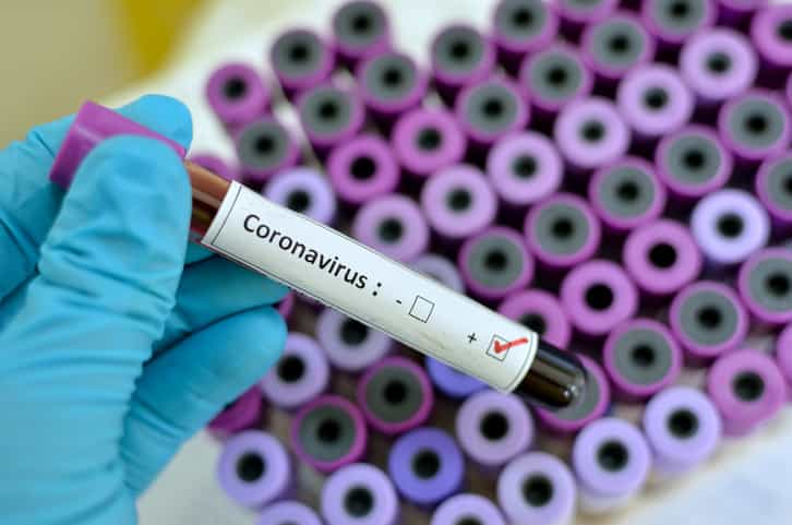 The first death of a coronavirus patient in Ireland has been confirmed The first death of a coronavirus patient in Ireland has been confirmed