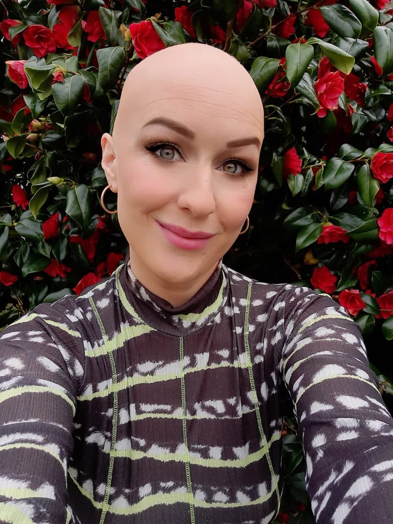 It changed my relationship with beauty: journalist Mary Cate Smith discusses her alopecia journey It changed my relationship with beauty: journalist Mary Cate Smith discusses her alopecia journey