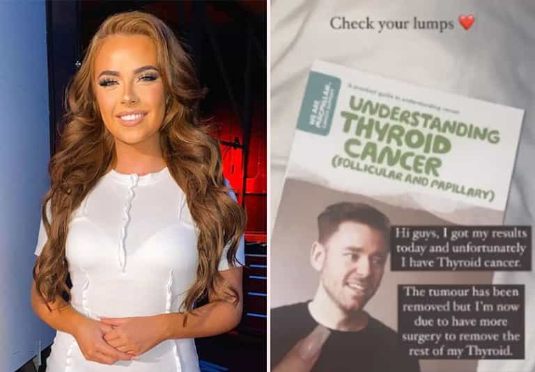 Demi Jones’ cancer tests were pushed back six times over seven months Demi Jones’ cancer tests were pushed back six times over seven months