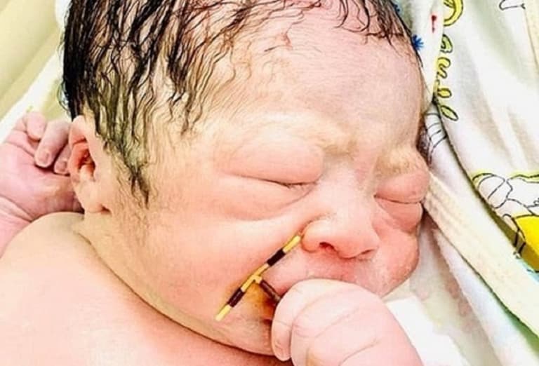 Baby pictured holding mum’s failed IUD after ‘miracle’ pregnancy Baby pictured holding mum’s failed IUD after ‘miracle’ pregnancy