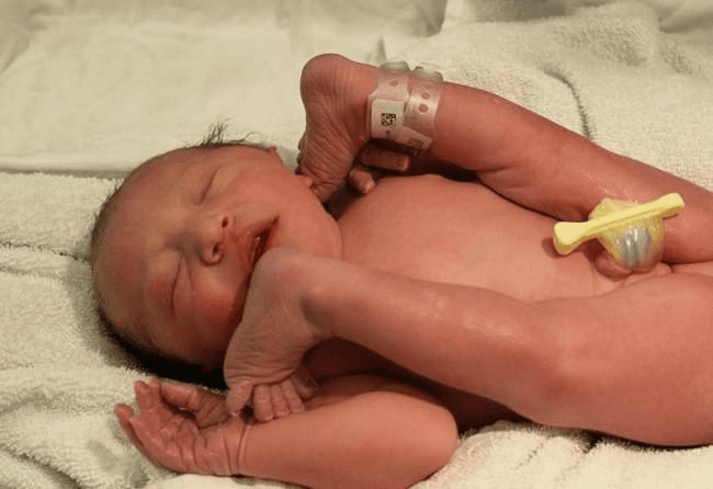 Amazing photo shows how a breach baby fits in the womb Amazing photo shows how a breach baby fits in the womb