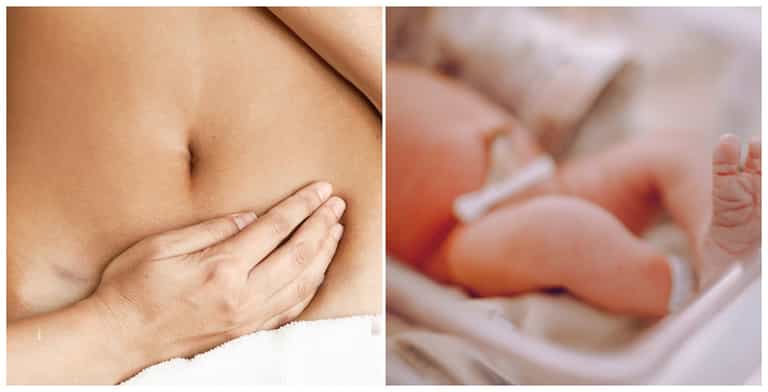 Husband wants wife to have C-section instead of vaginal delivery to ‘not ruin their sex life’ Husband wants wife to have C-section instead of vaginal delivery to ‘not ruin their sex life’