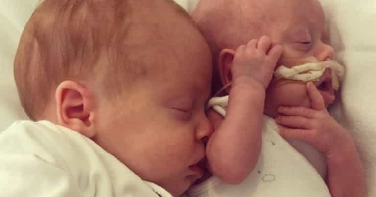 Premature twin born 3 times lighter than his brother left fighting for life Premature twin born 3 times lighter than his brother left fighting for life