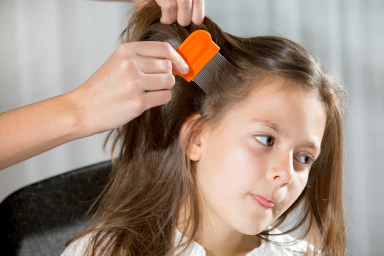 3 helpful tips for treating and preventing head lice at home 3 helpful tips for treating and preventing head lice at home