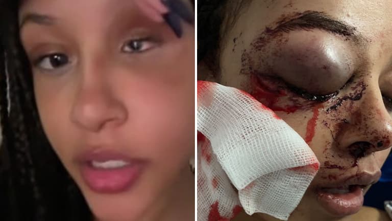 Alanna Quinn Idris shares heartbreaking update after Ballyfermot attack Alanna Quinn Idris shares heartbreaking update after Ballyfermot attack