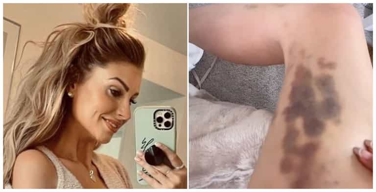 Mrs Hinch reveals why she always covers up – even in summer Mrs Hinch reveals why she always covers up – even in summer