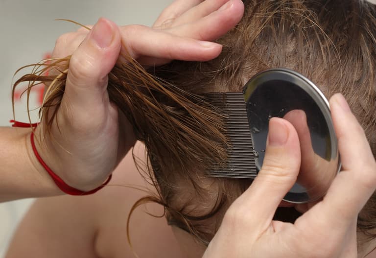 Irish children going without head lice treatment because parents can’t afford it Irish children going without head lice treatment because parents can’t afford it