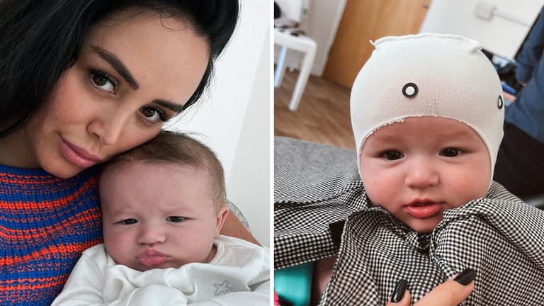 Marnie Simpson reveals her baby boy has plagiocephaly Marnie Simpson reveals her baby boy has plagiocephaly