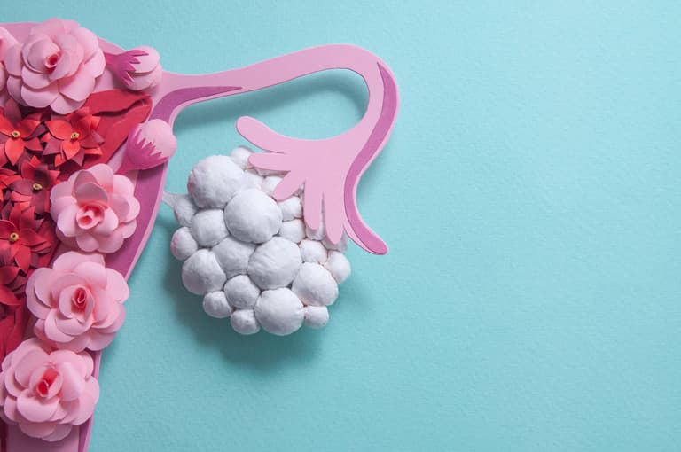 5 things all women should know about Polycystic Ovary Syndrome (PCOS) 5 things all women should know about Polycystic Ovary Syndrome (PCOS)