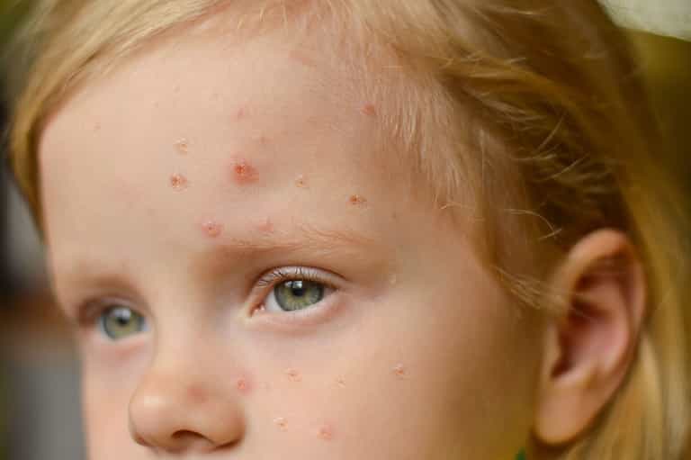 16 people have died from invasive Strep A since October, HSE confirms 16 people have died from invasive Strep A since October, HSE confirms