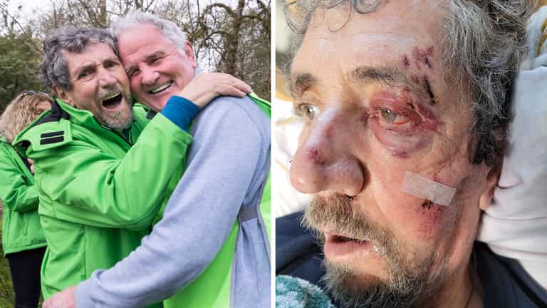 RTÉ’s Charlie Bird rushed to A&E following a bad fall RTÉ’s Charlie Bird rushed to A&E following a bad fall