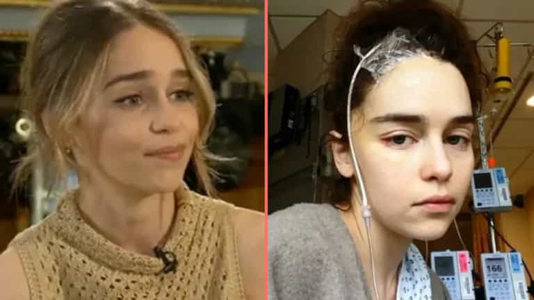 Emilia Clarke missing ‘quite a bit’ of her brain after two aneurysms and is ‘surprised’ she can speak Emilia Clarke missing ‘quite a bit’ of her brain after two aneurysms and is ‘surprised’ she can speak
