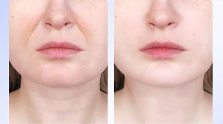 Shoppers ditch anti-ageing creams for €20 gadget designed to tighten skin Shoppers ditch anti-ageing creams for €20 gadget designed to tighten skin