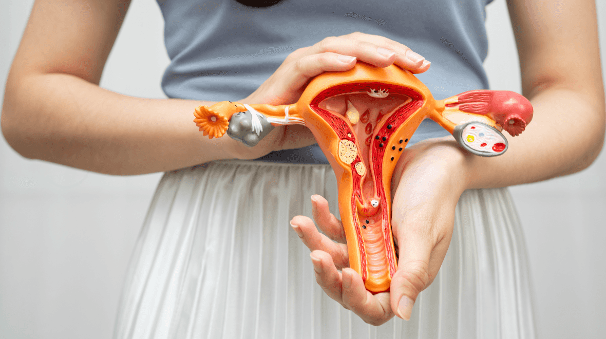 What is PCOS and why has it been renamed? What is PCOS and why has it been renamed?
