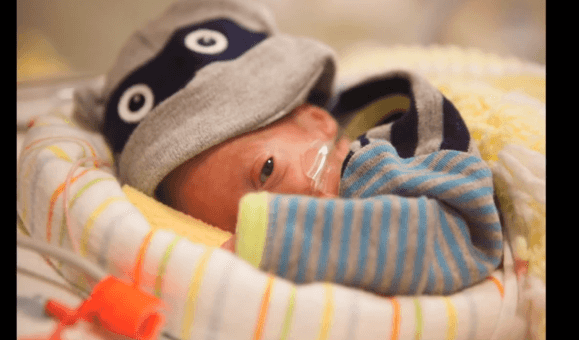 WATCH: 80 Days in ICU. The incredible time-lapse video of a premature baby WATCH: 80 Days in ICU. The incredible time-lapse video of a premature baby