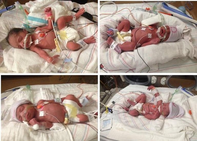 NEWS: Arizona woman dies after giving birth to quadruplets NEWS: Arizona woman dies after giving birth to quadruplets
