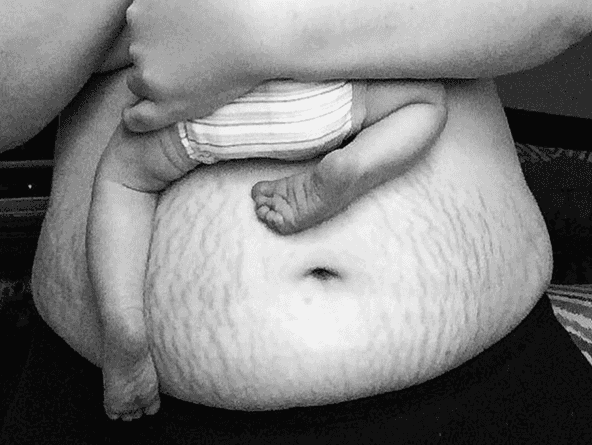 Why the post-baby body selfie is not total bullsh*t: HerFamily.ie readers on their Mum-bods Why the post-baby body selfie is not total bullsh*t: HerFamily.ie readers on their Mum-bods