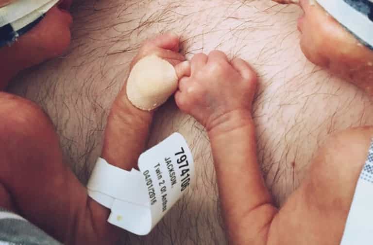 Incredible Moment Premature Twins Hold Hands Incredible Moment Premature Twins Hold Hands