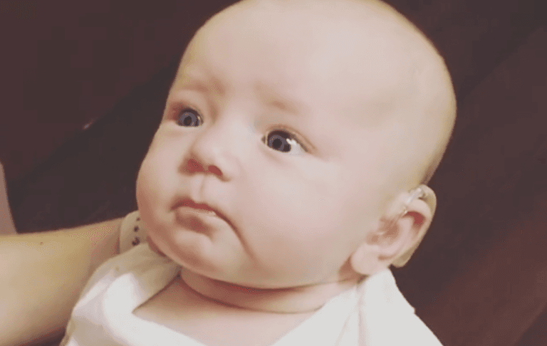 Video of ‘profoundly deaf’ baby hearing mum speak for first time Video of ‘profoundly deaf’ baby hearing mum speak for first time