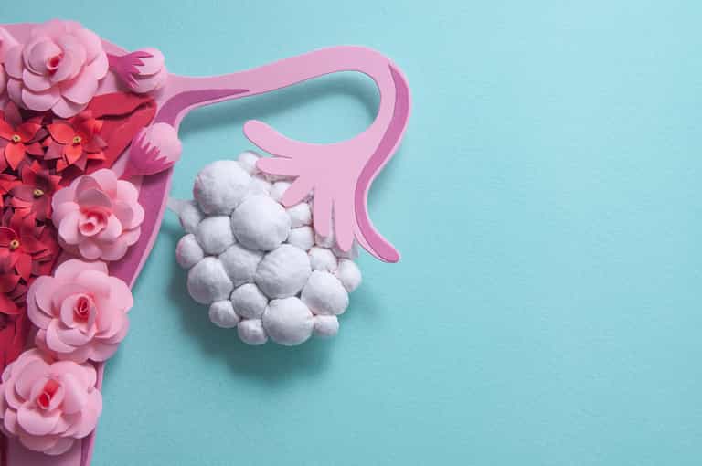5 things all women should know about Polycystic Ovary Syndrome (PCOS) 5 things all women should know about Polycystic Ovary Syndrome (PCOS)