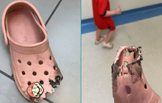 Mum issues warning about wearing Crocs after daughter’s ‘freak accident’ Mum issues warning about wearing Crocs after daughter’s ‘freak accident’